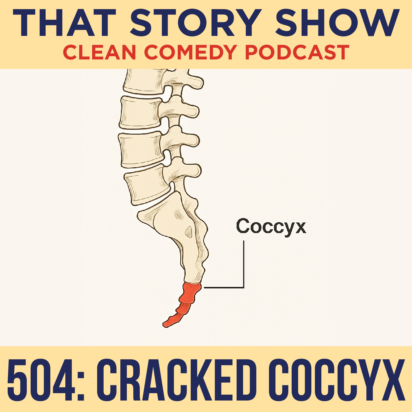 504: Crushed Coccyx